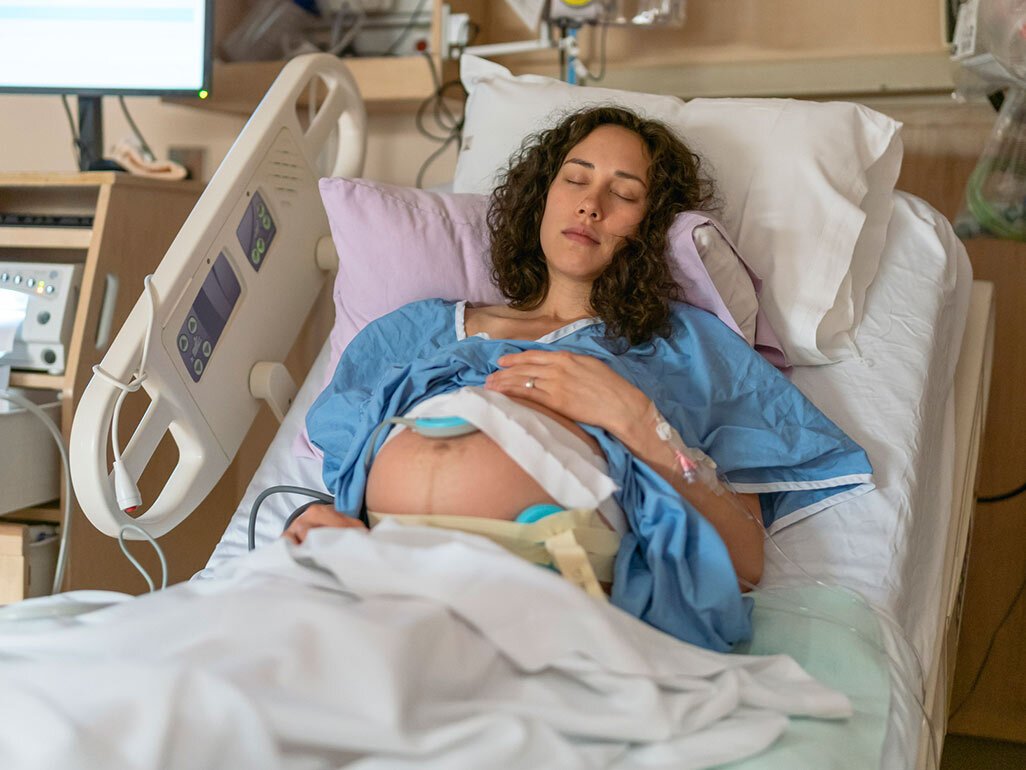 Can You Go Home With a Foley Bulb Induction