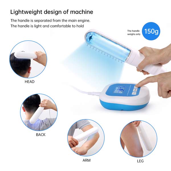 How to Use Uvb Lamp for Vitiligo at Home